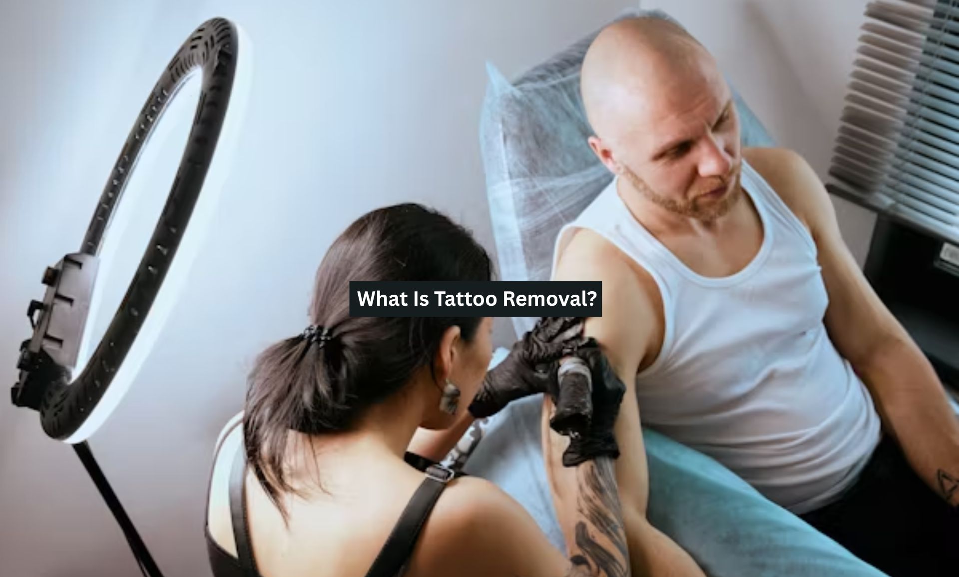 Tattoo Removal